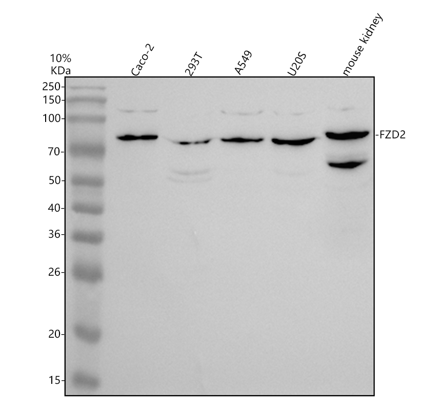 Western blot analysis of Frizzled 2/FZD2 using anti-Frizzled 2/FZD2 antibody (A05675-2)