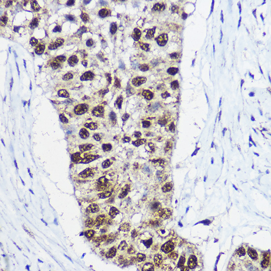 a05676 smarca1 primary antiboties ihc testing 2