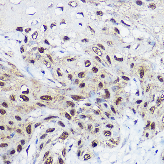 a05676 smarca1 primary antiboties ihc testing 3