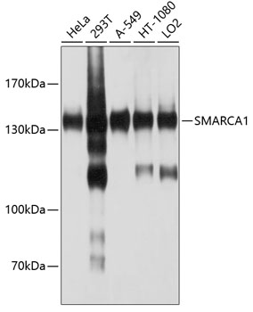 a05676 smarca1 primary antiboties wb testing 1