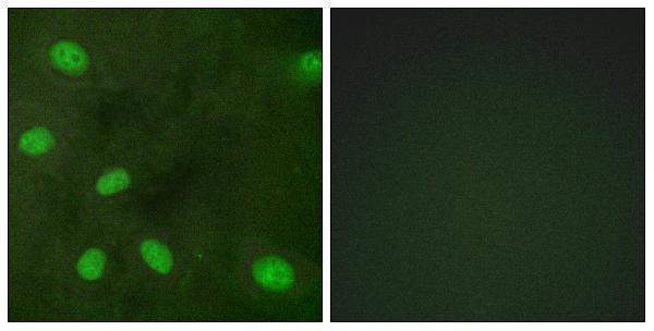 Immunofluorescence analysis of HeLa cells, using GIRK1/KIR3