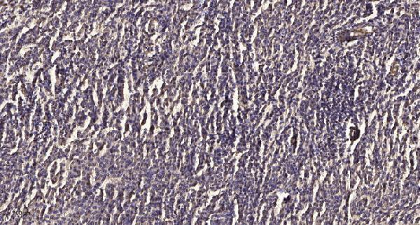 Immunohistochemical analysis of paraffin-embedded human meningioma