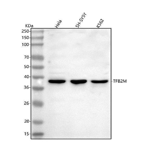  Western blot analysis of TFB2M using anti-TFB2M antibody (A05679-2)
