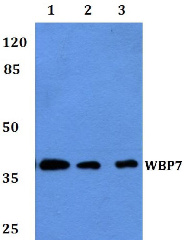 a05680 kmt2b primary antiboties wb testing 1