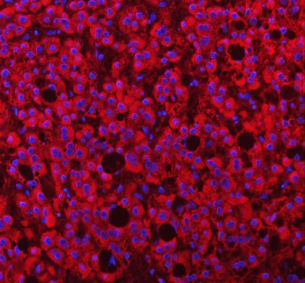 a05684 1 papss2 primary antibodies if testing 6