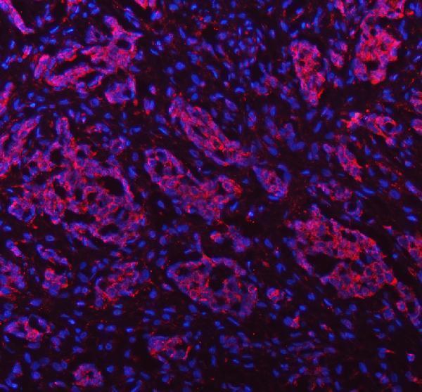 a05684 1 papss2 primary antibodies if testing 7