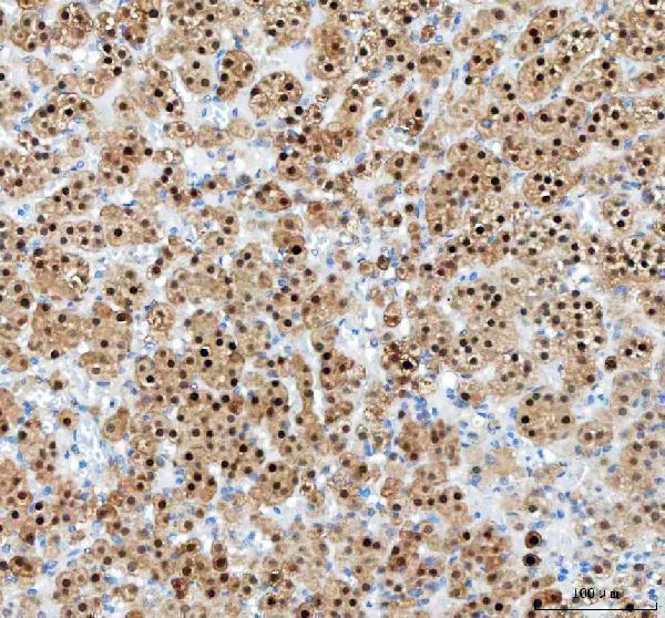  IHC analysis of PAPSS2 using anti-PAPSS2 antibody (A05684-1)