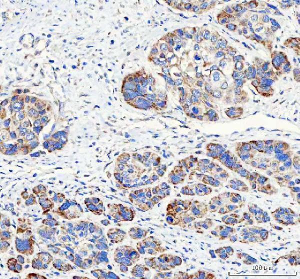  IHC analysis of PAPSS2 using anti-PAPSS2 antibody (A05684-1)