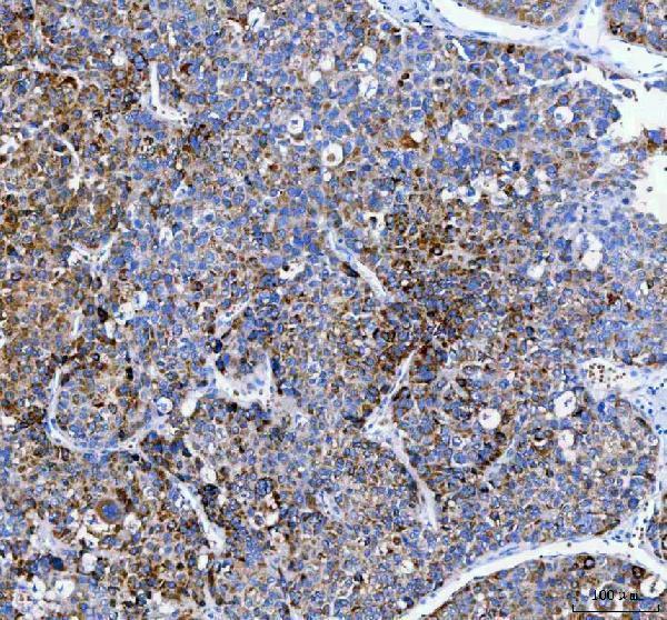 a05684 1 papss2 primary antibodies ihc testing 4
