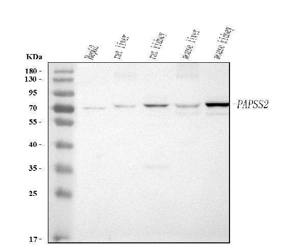  Western blot analysis of PAPSS2 using anti-PAPSS2 antibody (A05684-1)