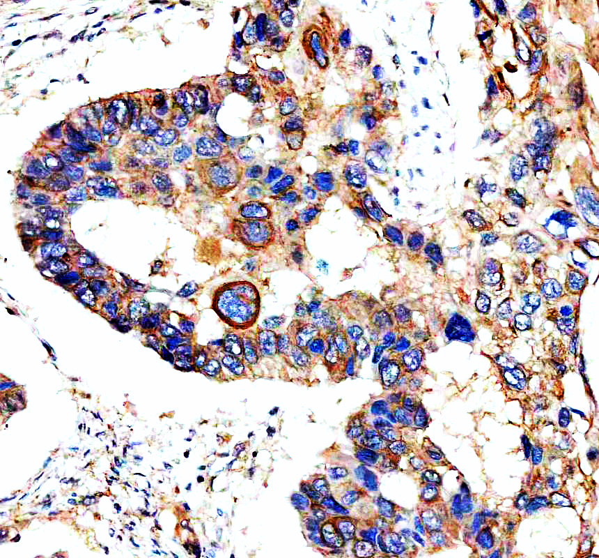 a05685 1 napsa primary antibodies ihc testing 1