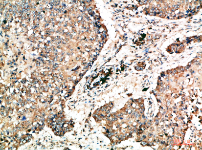 a05685 napsa primary antibodyes ihc testing 1
