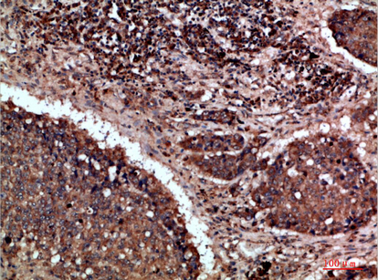 a05685 napsa primary antibodyes ihc testing 2