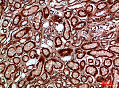 a05685 napsa primary antibodyes ihc testing 3