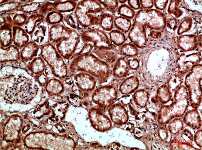 a05685 napsa primary antibodyes ihc testing 4