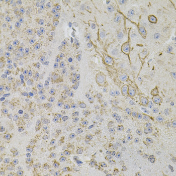 Immunohistochemistry of paraffin-embedded mouse brain using REG3A antibody  