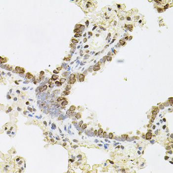 Immunohistochemistry of paraffin-embedded rat lung using REG3A antibody  