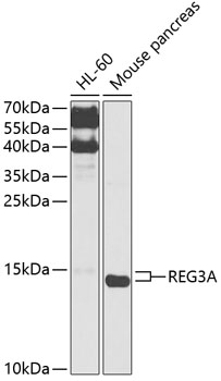 Western blot analysis of extracts of various cell lines, using REG3A antibody  at 1:1000 dilution