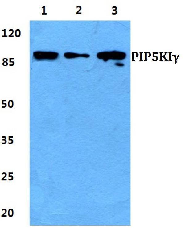 a05687 1 pip5k1c primary antiboties wb testing 1
