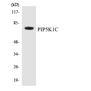 a05687 pip5k1c primary antibodies wb testing 1