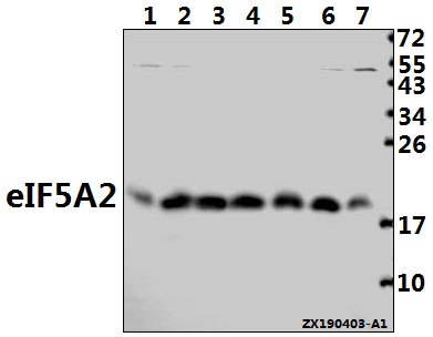 a05688y127 eif5a2 primary antiboties wb testing 1