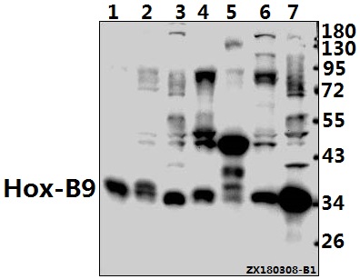 Western blot (WB) analysis of Hox-B9 (R237) pAb at 1:1000 dilution
Lane1:The Placenta tissue lysate of Rat(40ug)
Lane2:LOVO whole cell lysate(40ug)
Lane3:HCT116 whole cell lysate(40ug)
Lane4:The Testis tissue lysate of Rat(40ug)
Lane5:The Embryo tissue lysate of Mouse(40ug)
Lane6:Hela whole cell lysate(40ug)
Lane7:HEK293T whole cell lysate(40ug)