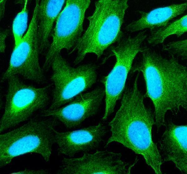 IF analysis of SHANK1 using anti-SHANK1 antibody (A05690-2)