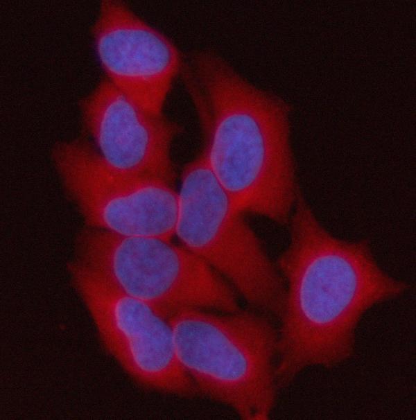 a05692 1 st13 primary antibodies if testing 2