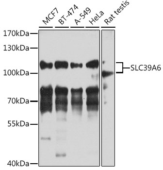 Western blot analysis of extracts of various cell lines, using SLC39A6 antibody  at 1:1000 dilution