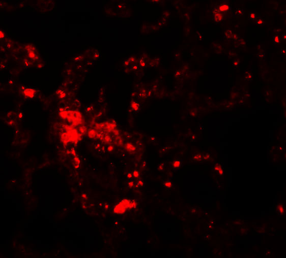 Immunofluorescence of ZIP6 in mouse lung tissue with ZIP6 antibody at 20 μg/mL