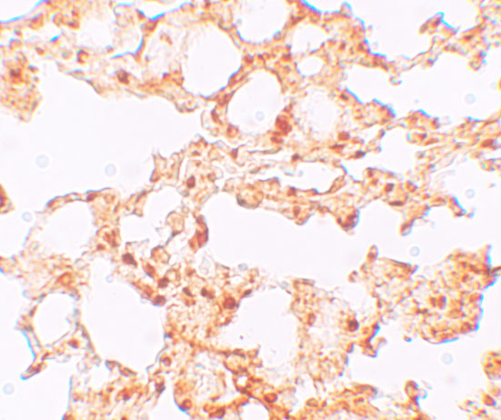 Immunohistochemistry of ZIP6 in mouse lung tissue with ZIP6 antibody at 5 μg/mL