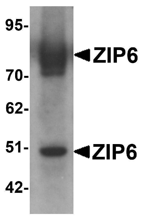 Western blot analysis of ZIP6 in mouse lung tissue lysate with ZIP6 antibody at 1 μg/mL