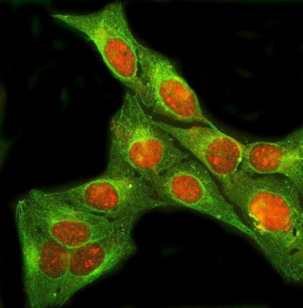  IF analysis of SIX4 using anti-SIX4 antibody (A05695-1) and anti-Beta Tubulin antibody (M01857-3)