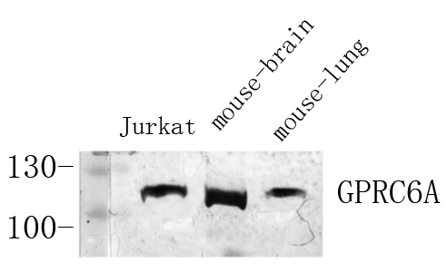 Western Blot analysis of various cells using Antibody diluted at 1:1000