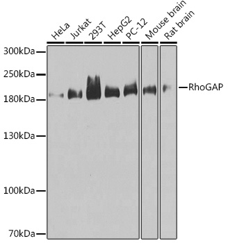 a05701 arhgap5 primary antiboties wb testing 1