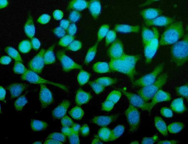 a05704 2 cpn1 primary antibodies if testing 2