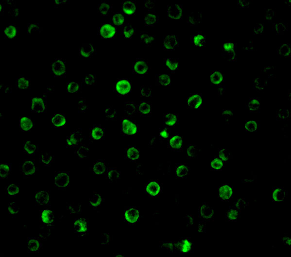 Immunofluorescence of IL-22 receptor in HepG2 cells with IL-22 receptor antibody at 10 μg/mL
