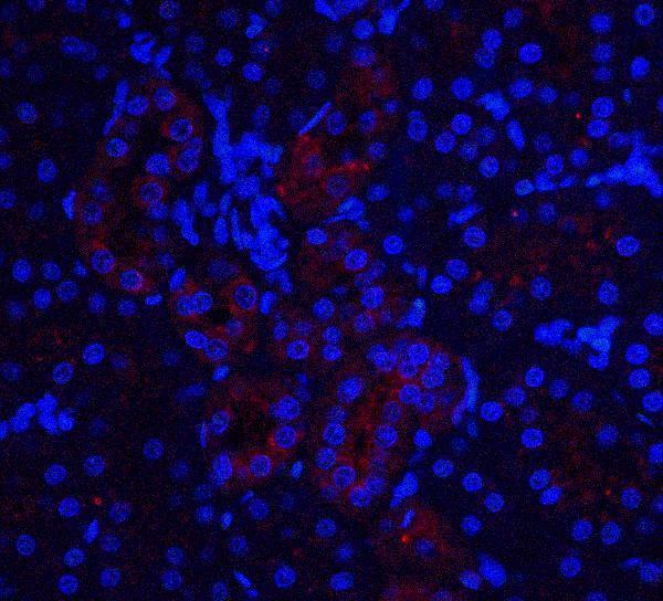 a05705 1 il22ra1 primary antibodies if testing 5