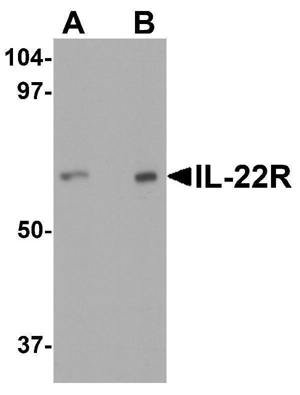Western blot analysis of IL-22 receptor expression in human HepG2 cell lysate with IL-22 receptor antibody at (A) 0