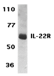 Western blot analysis of IL-22 Receptor expression in human HepG2 cell lysate with IL-22 Receptor antibody at 1 μg/ml