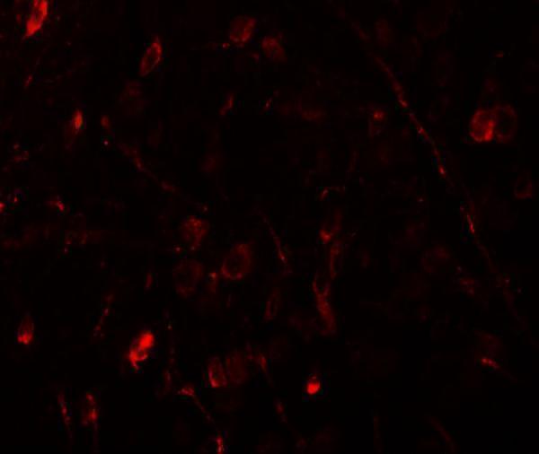 Immunofluorescence of WIZ in human brain tissue with WIZ antibody at 20 μg/mL