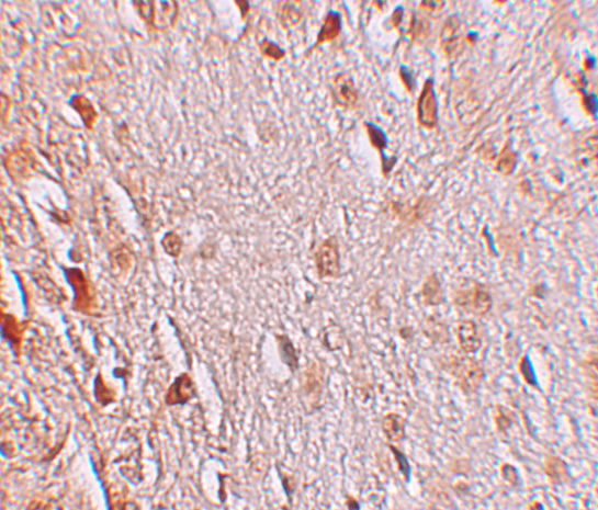 Immunohistochemistry of WIZ in human brain tissue with WIZ antibody at 2