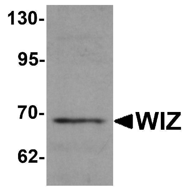 Western blot analysis of WIZ in rat lung tissue lysate with WIZ antibody at 1 μg/mL