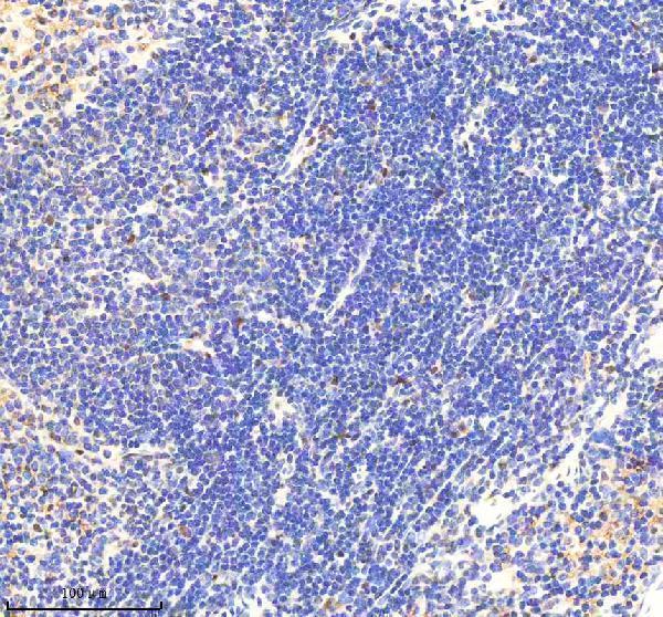  IHC analysis of RNF111 using anti-RNF111 antibody (A05708-1)
