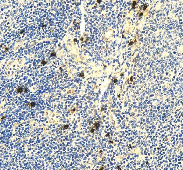 IHC analysis of RNF111 using anti-RNF111 antibody (A05708-1)