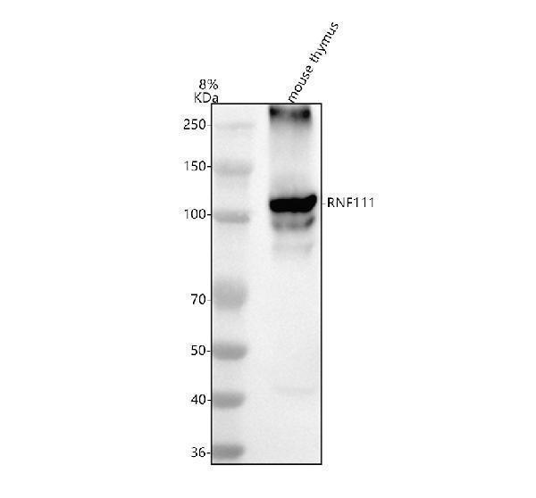  Western blot analysis of RNF111 using anti-RNF111 antibody (A05708-1)