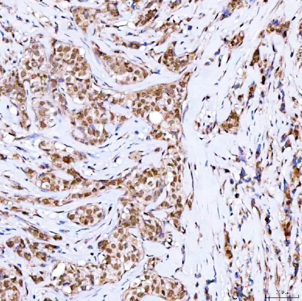  IHC analysis of Symplekin/SYMPK using anti-Symplekin/SYMPK antibody (A05709-1)