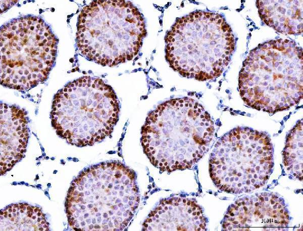 a05709 1 sympk primary antibodies ihc testing 6