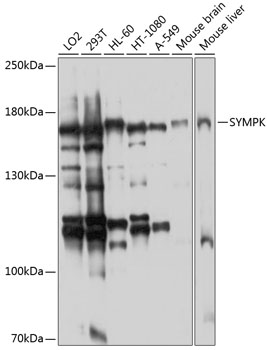 Western blot analysis of extracts of various cell lines, using SYMPK antibody  at 1:1000 dilution