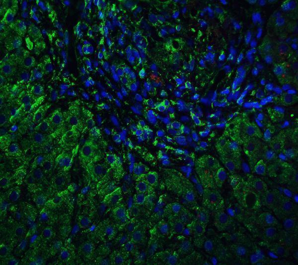 a05711 vps39 primary antibodies if testing 4